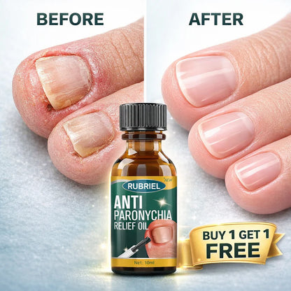 Nailora™ Professional Nail & Cuticle Renewal Serum Buy 1 Get 1 Free